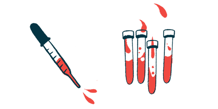 An illustration of blood samples to go through laboratory testing.